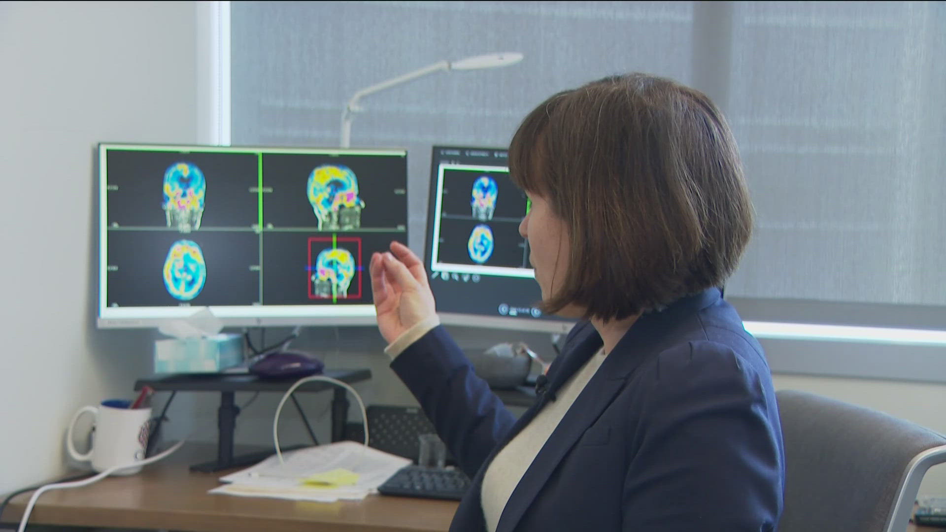 The $5.2 million grant funds the study, 'Women: Inflammation and Tau' researchers are looking for more participants.